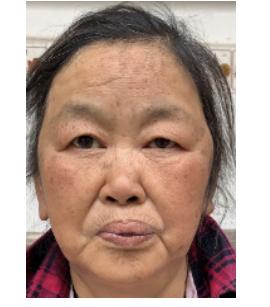 走失者照片 广安寻亲：六旬老太被救助，自述叫刘...