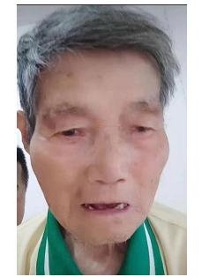 走失者照片 南昌急寻：八旬老人走失，穿蓝色上衣...