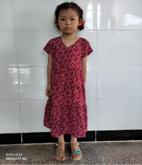 走失者照片 寻亲：5岁女孩在金华义乌被救助多年...