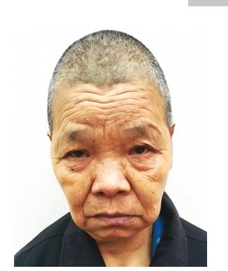 走失者照片 驻马店寻亲：七旬老太被救助，高1米...
