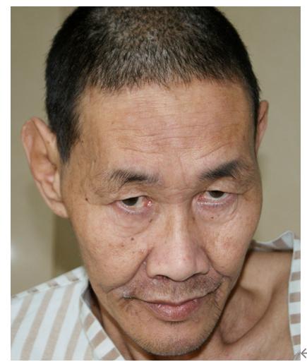 走失者照片 杭州寻亲：六旬老人被救助，患精神分...