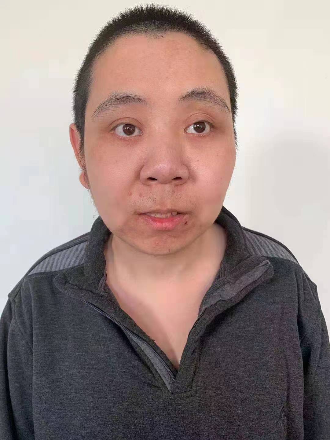 走失者照片 廊坊寻亲：青年男子被救助多年，表述...