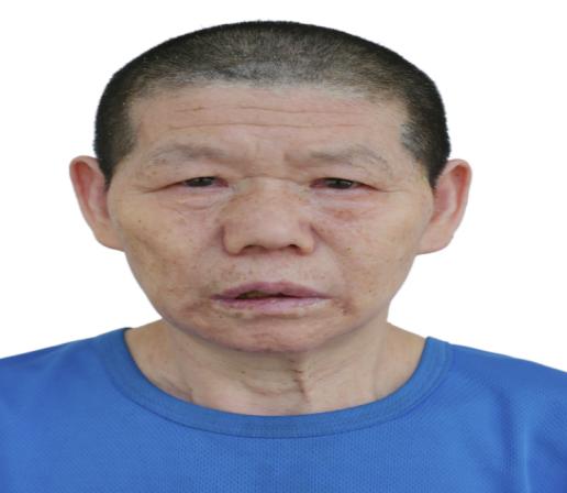 走失者照片 吉安寻亲：六旬老太被救助，短发，高...