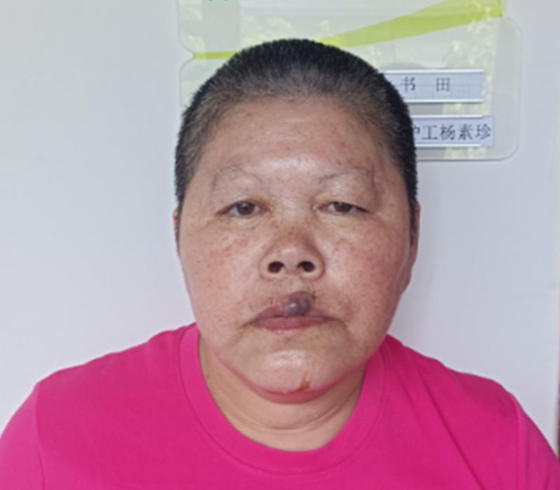 走失者照片 杭州寻亲：五旬女子被救助，精神发育...