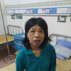 走失者照片 钦北寻亲：中年女子被救助，高1米5...