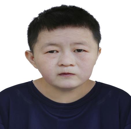 走失者照片 吉安寻亲：青年女子被救助，高1米4...