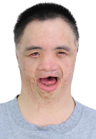 走失者照片 佛山寻亲：青年男子被救助，疑似广东...
