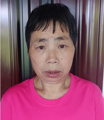 走失者照片 杭州寻亲：五旬女子被救助，左脸有颗...