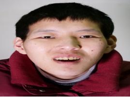 走失者照片 金华义乌寻亲：青年女子被救助，穿红...