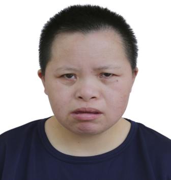 走失者照片 吉安寻亲：青年女子被救助，疑似精神...