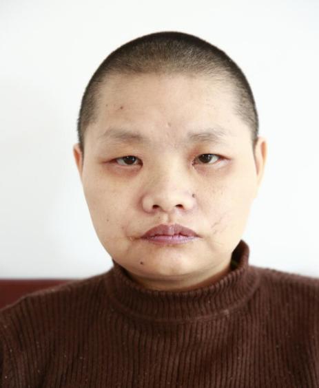 走失者照片 台州寻亲：临海中年女子被救助多年，...