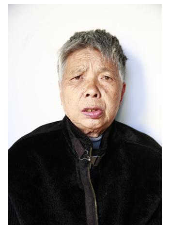 走失者照片 台州临海寻亲：七旬老太被救助，精神...