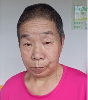 走失者照片 急寻家属：杭州七旬老太被救助多年，...