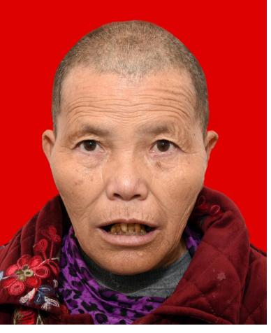 走失者照片 怀化寻亲：六旬老太被救助，高约1米...
