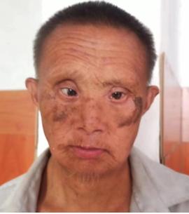 走失者照片 南阳寻亲：五旬男子被救助，穿浅灰色...