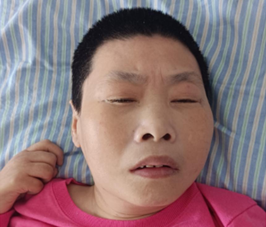 走失者照片 杭州寻亲：中年女子被救助，精神发育...