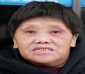 走失者照片 金华义乌寻亲：六旬老太被救助，穿黑...