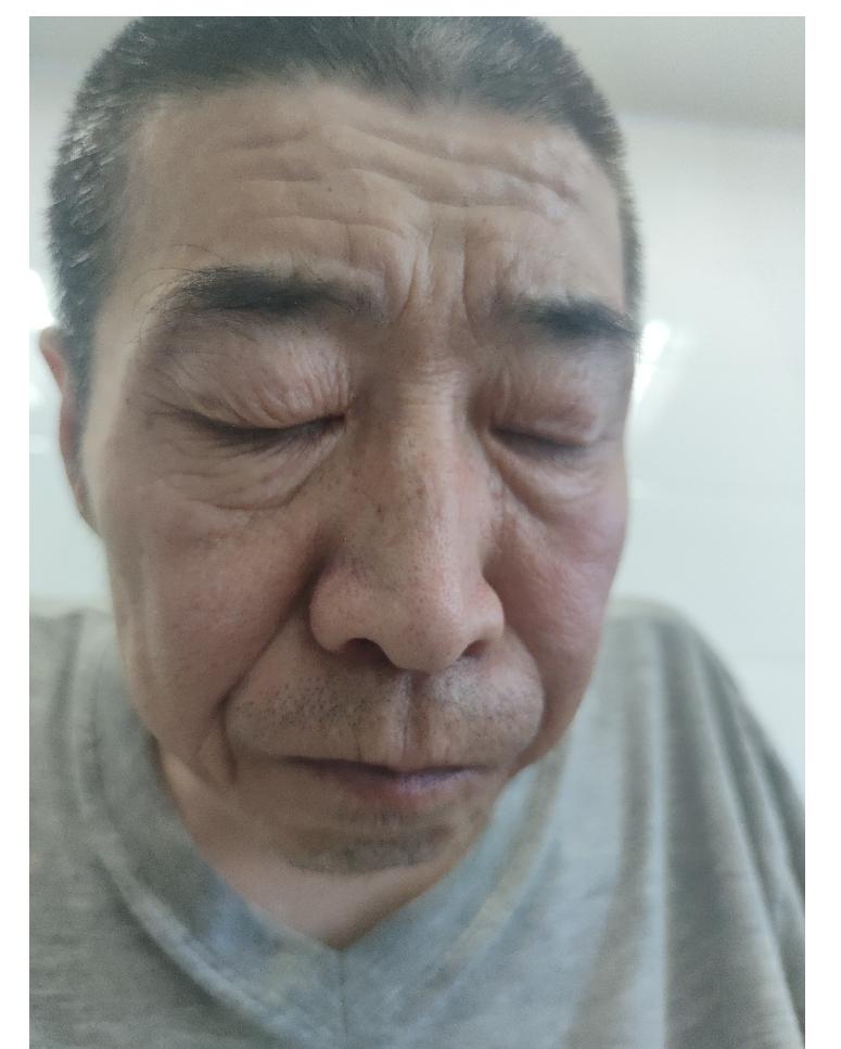 走失者照片 大连寻亲：六旬老人被救助，高1米6...