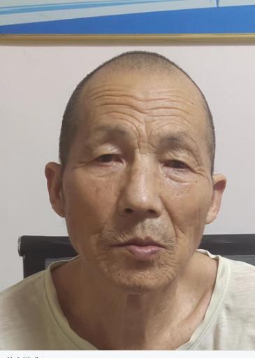 走失者照片 平顶山寻亲：六旬老人被救助，高1米...