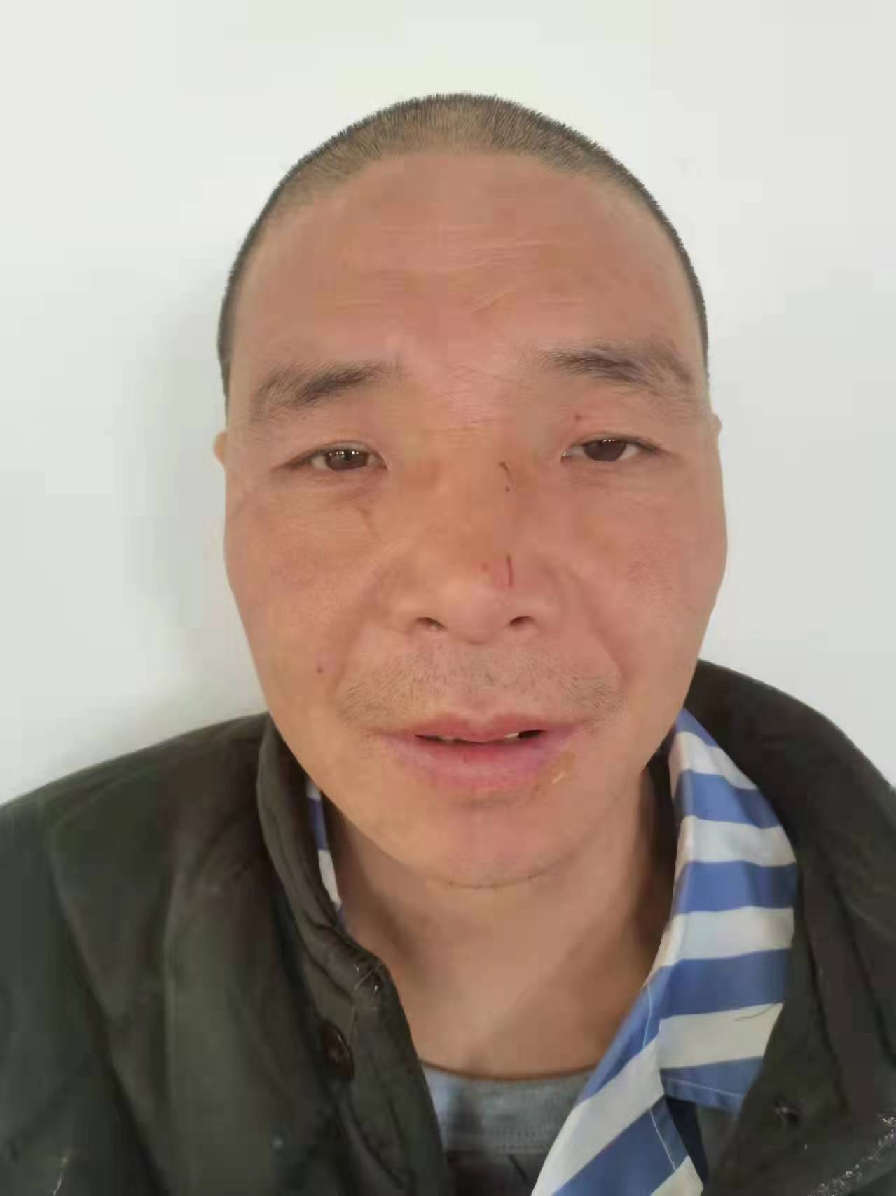 走失者照片 庆阳寻亲！青年男子被救助，穿迷彩外...