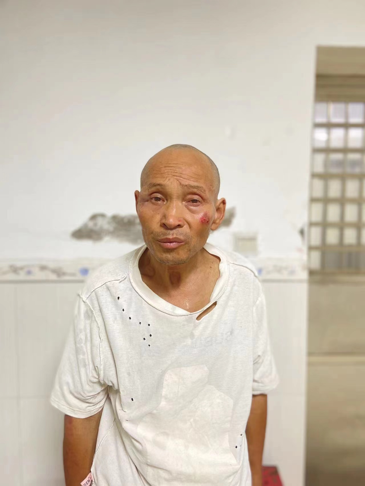 走失者照片 衡阳耒阳寻亲：五旬男子被救助，脸部...