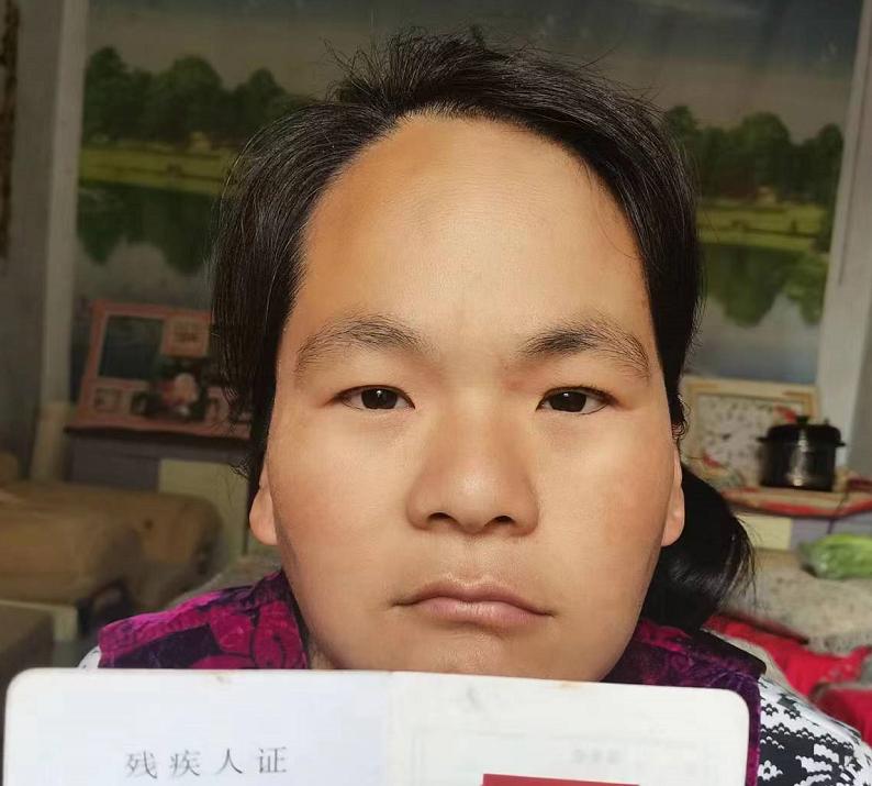走失者照片 阜阳急寻：青年女子走失，患精神障碍...