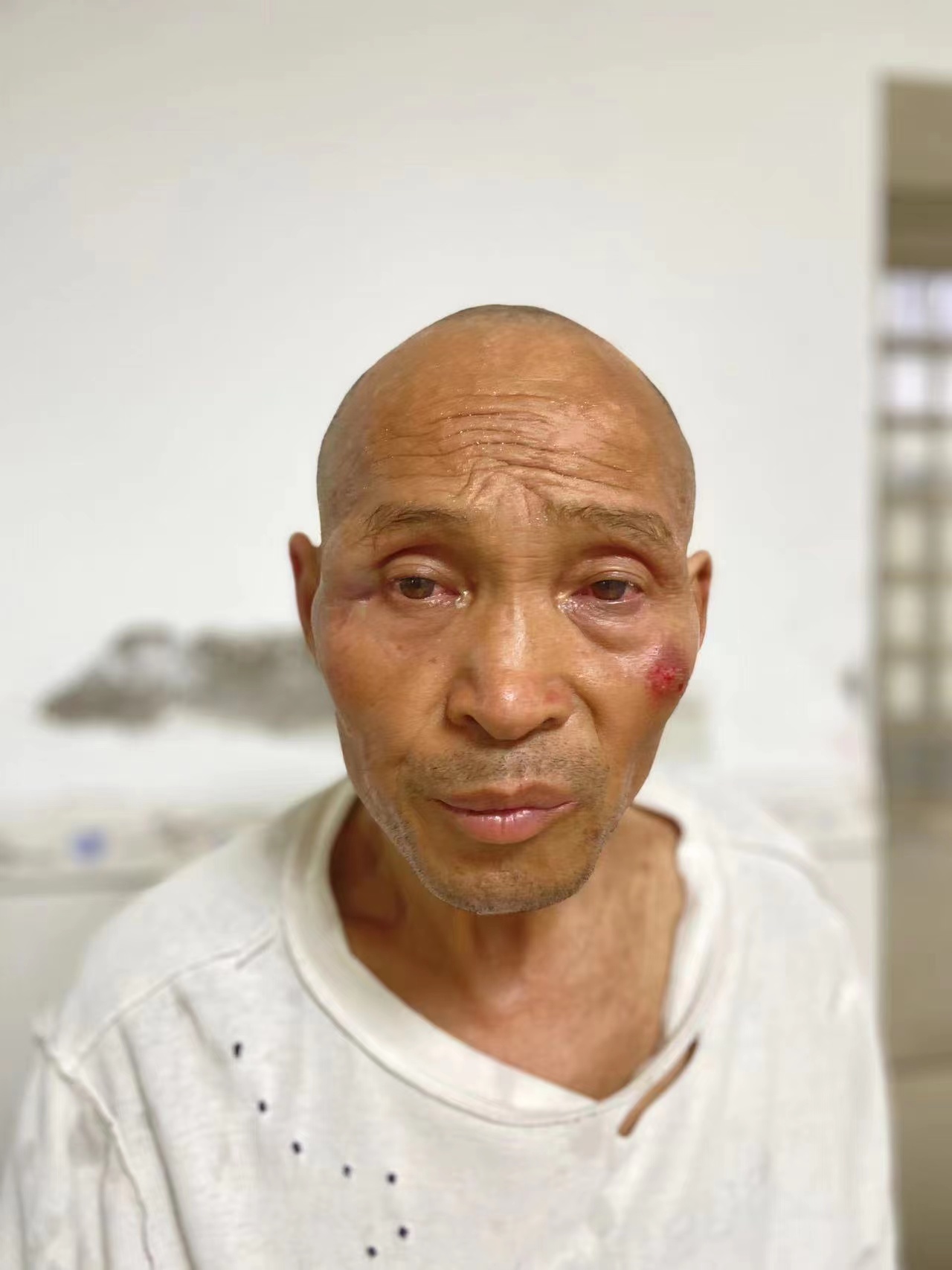 走失者照片 衡阳耒阳寻亲：五旬男子被救助，脸部...