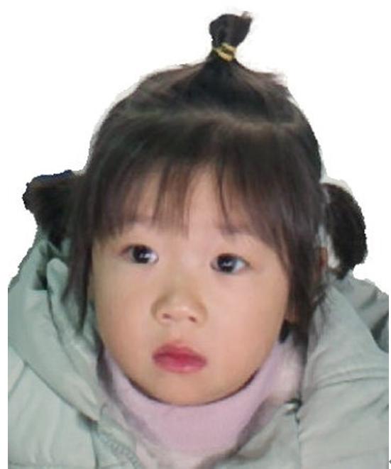 走失者照片 遂宁寻亲：5岁女孩自幼被救助，被发...