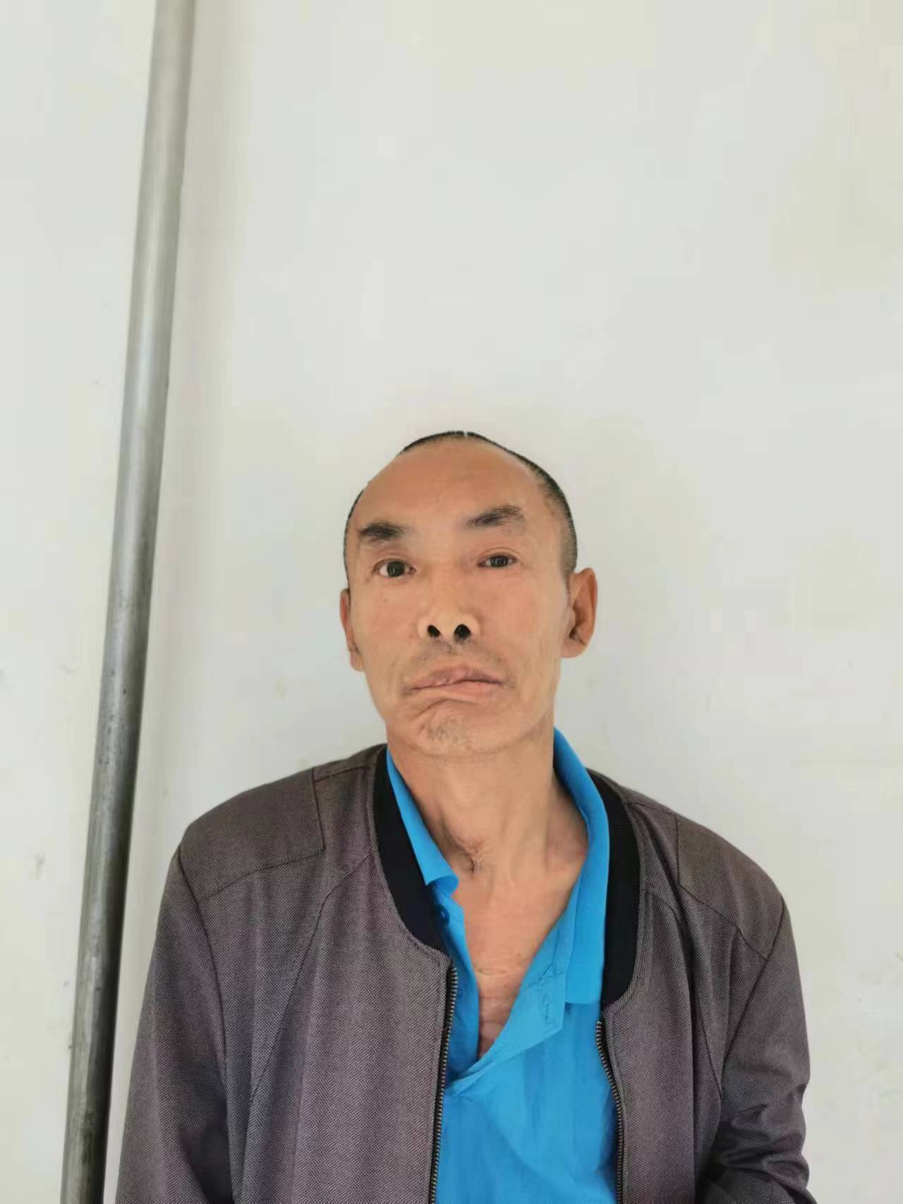 走失者照片 佳木斯寻亲：五旬男子被救助，自述叫...