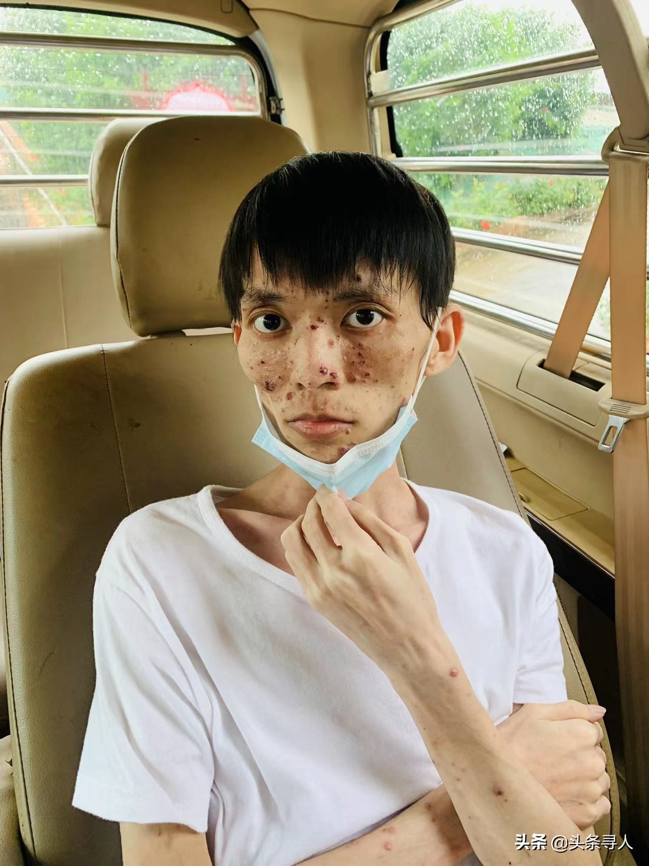 走失者照片 佛山寻亲：青年男子被救助，精神异常...