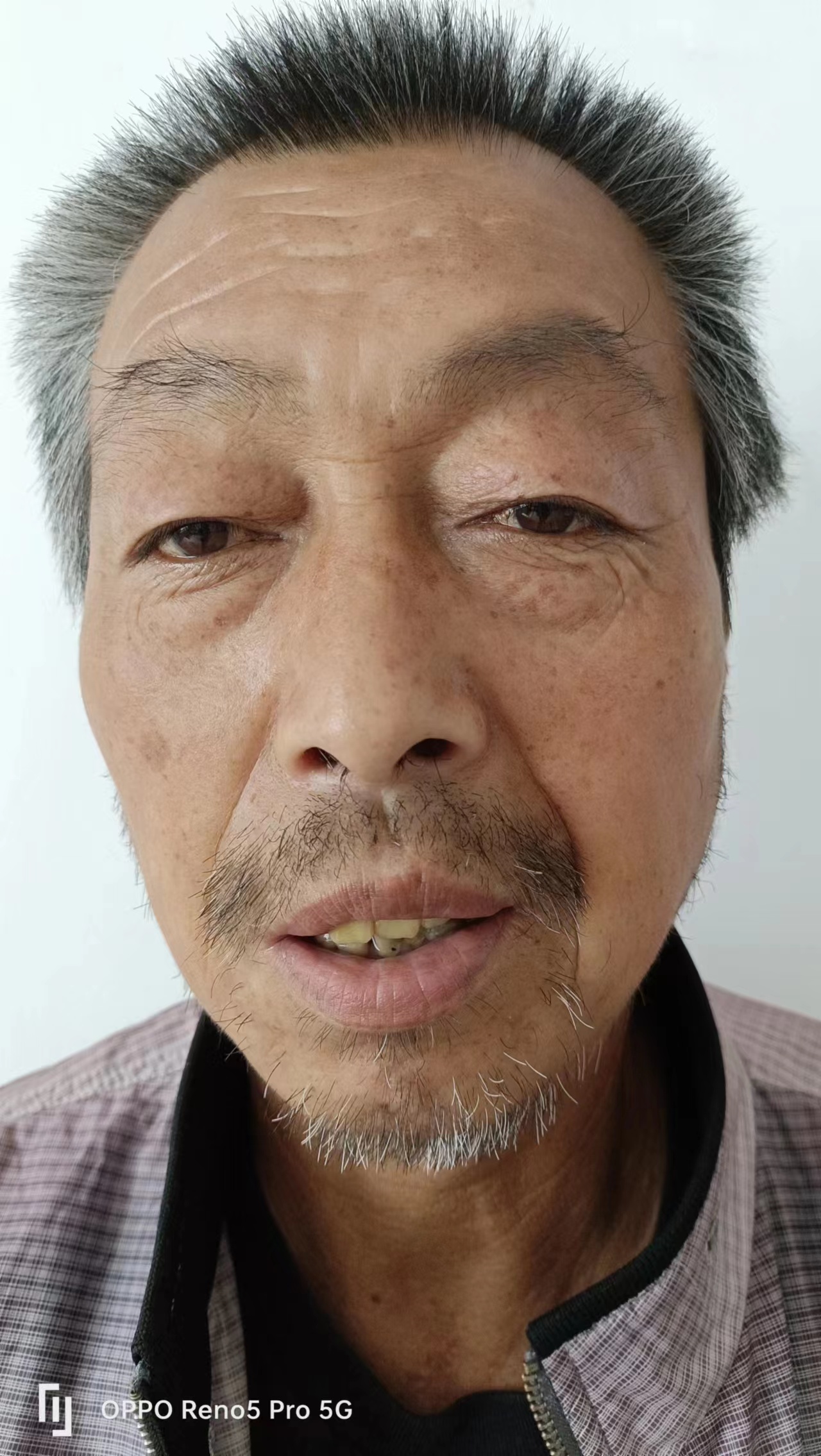走失者照片 佳木斯寻亲：六旬老人被救助，自述叫...