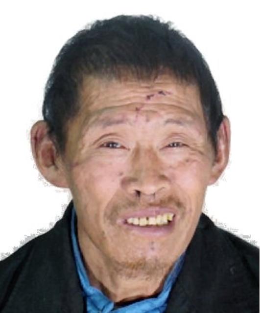 走失者照片 重庆寻亲：中年男子被救助，被收留时...