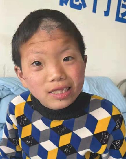 走失者照片 驻马店寻亲：18岁少年被救助，穿花...