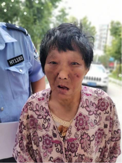 走失者照片 周口寻亲：七旬老太被救助，穿红色花...