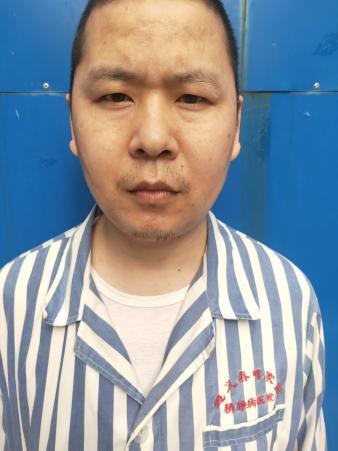 走失者照片 遵义寻亲：青年男子被救助，自述叫杨...