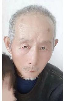 走失者照片 荆门急寻：七旬老人走失，穿白色衬衫...
