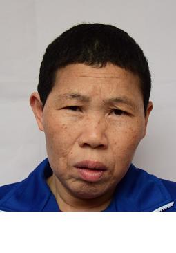 走失者照片 厦门寻亲：中年女子被救助，疑似是泉...