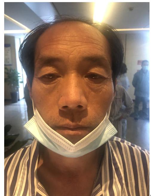 走失者照片 温州寻亲：六旬老人被救助，高约1米...