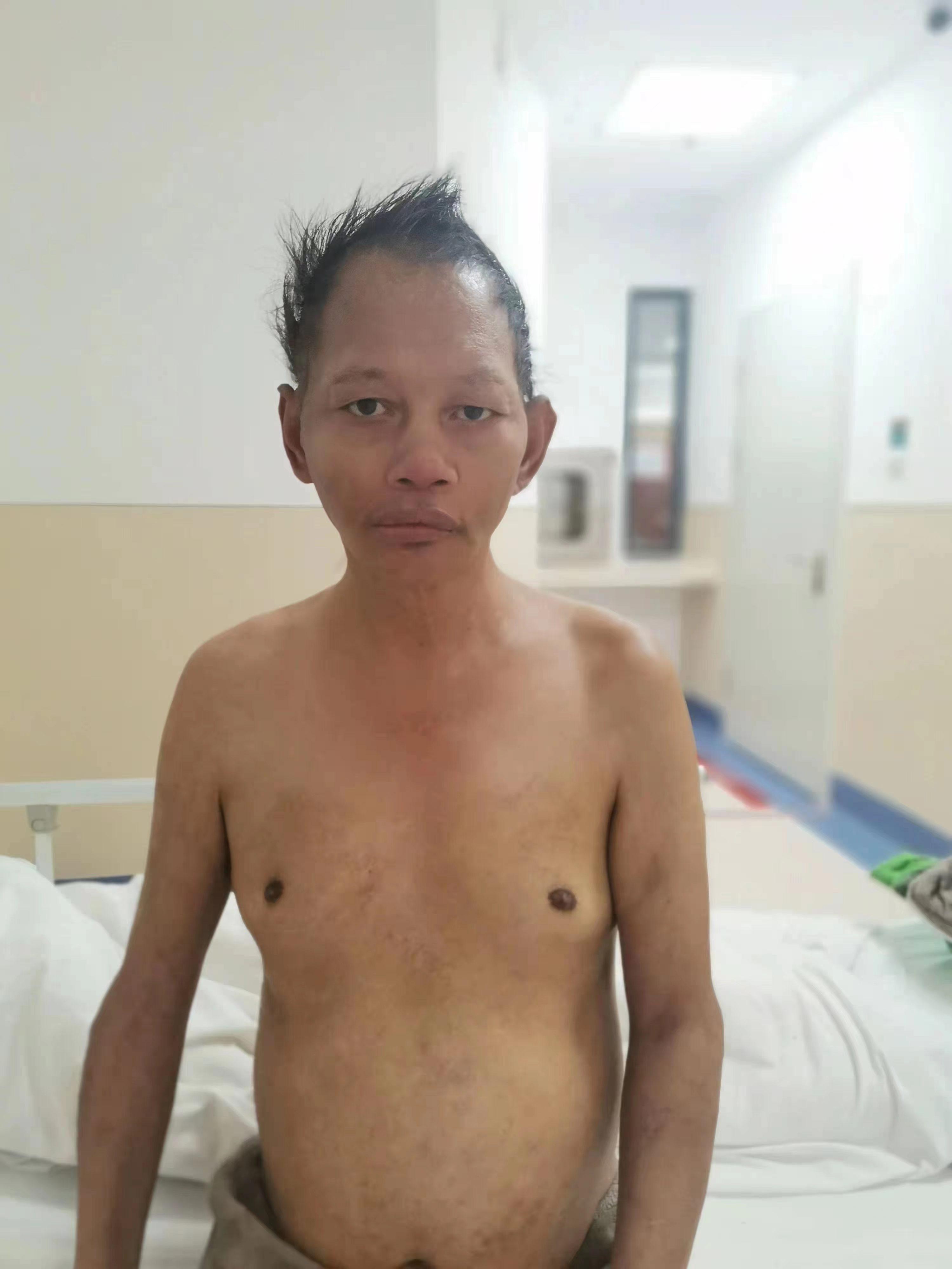 走失者照片 贵阳寻亲：五旬男子被救助，哑巴，高...