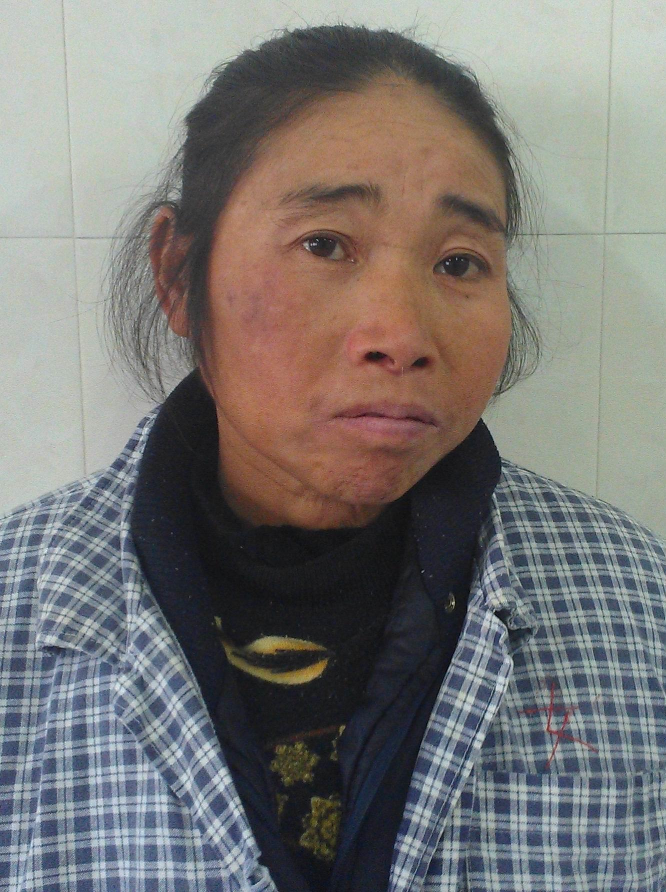 走失者照片 宁波寻亲：余姚五旬女子被救助多年，...