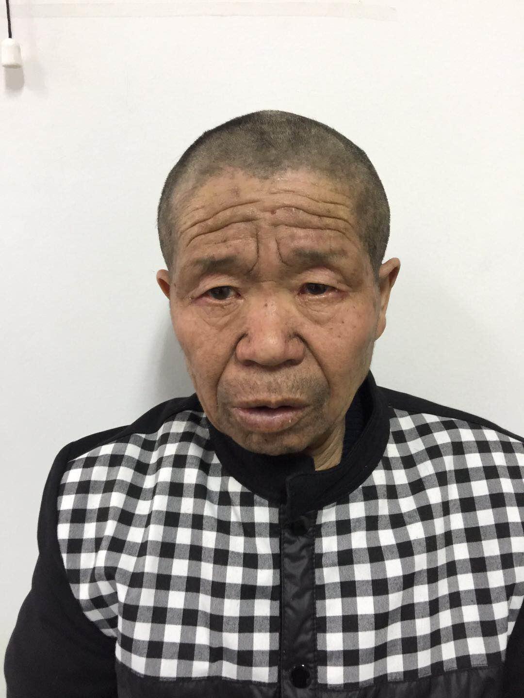 走失者照片 宁波寻亲：余姚五旬男子被救助多日，...