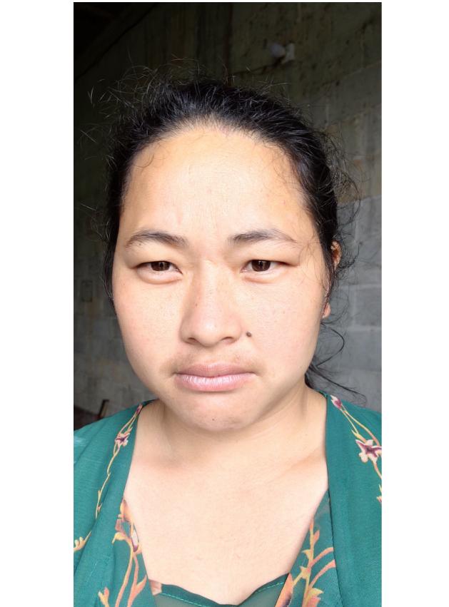 走失者照片 南宁寻亲：中年女子被救助，穿绿底花...