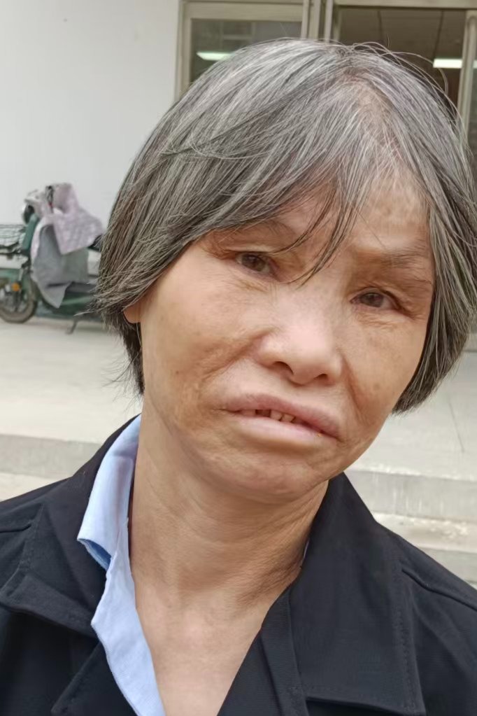 走失者照片 全国救助站
