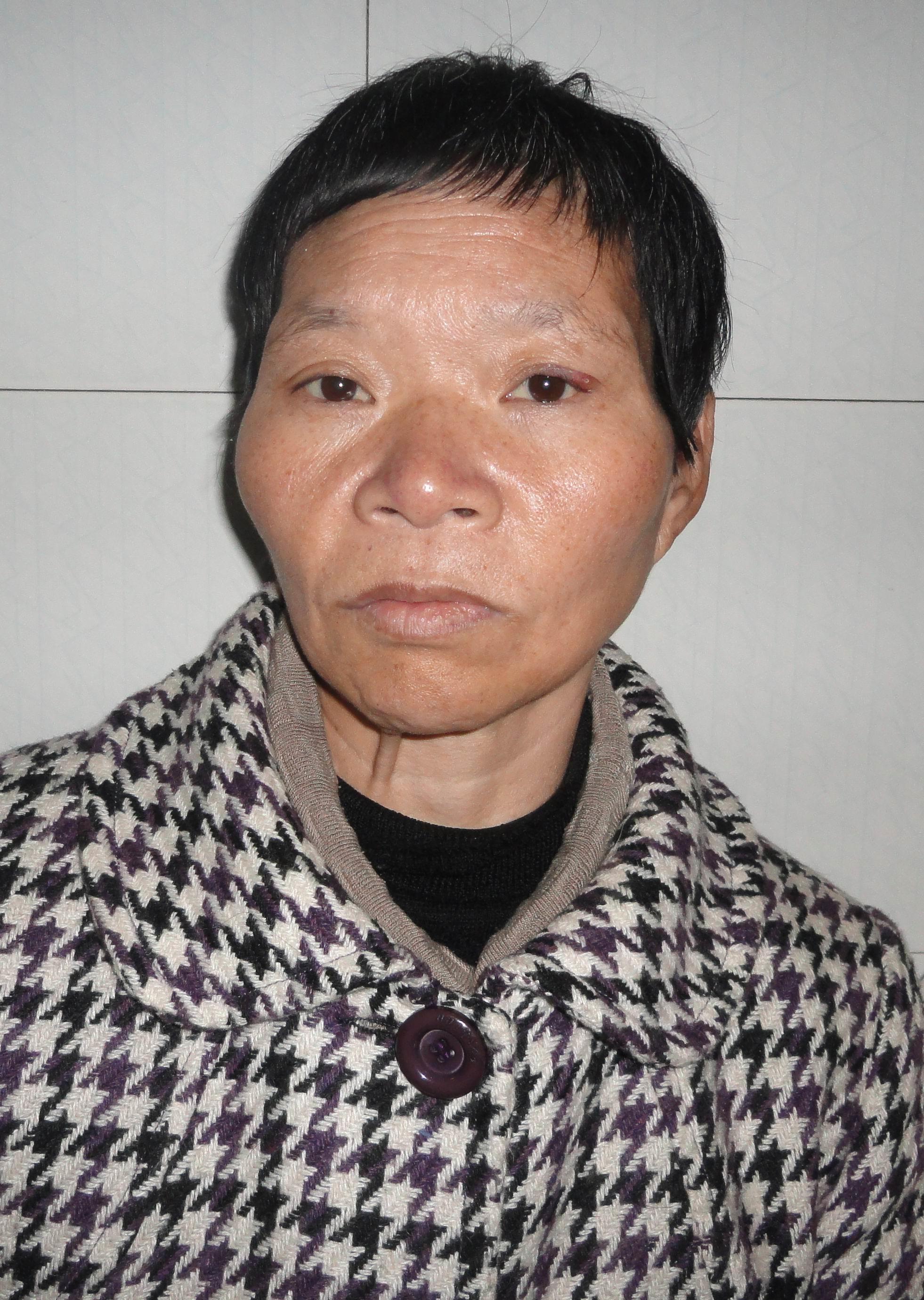走失者照片 宁波寻亲：余姚六旬老太被救助，高颧...