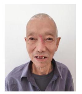 走失者照片 鹰潭寻亲：八旬老人被救助多日，精神...