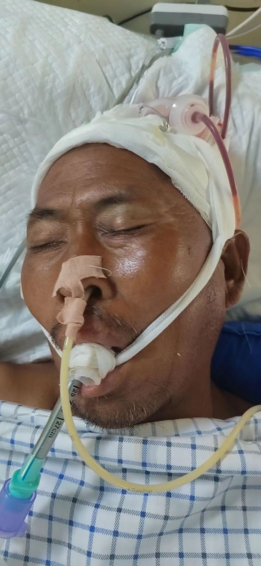 走失者照片 阜阳寻亲：五旬男子因车祸被送医，穿...
