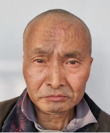 走失者照片 安庆寻亲：五旬男子被救助，高1米6...