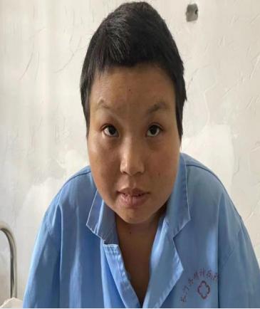 走失者照片 龙岩寻亲：中年女子被救助，高1米6...