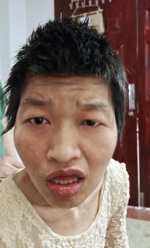 走失者照片 开封寻亲：中年女子被救助，高1米6...