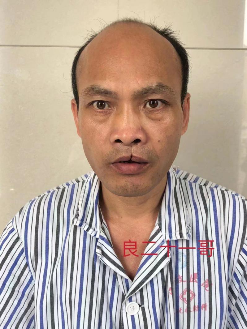 走失者照片 寻亲：中年男子在南宁被救助多年，疑...